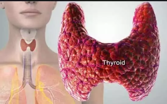 thyroid gland