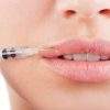 HOW DO LIP FILLERS WORK?
