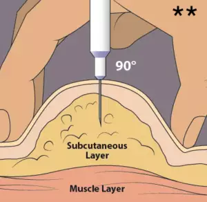 melanotan 2 tanning injection how to insert the needle